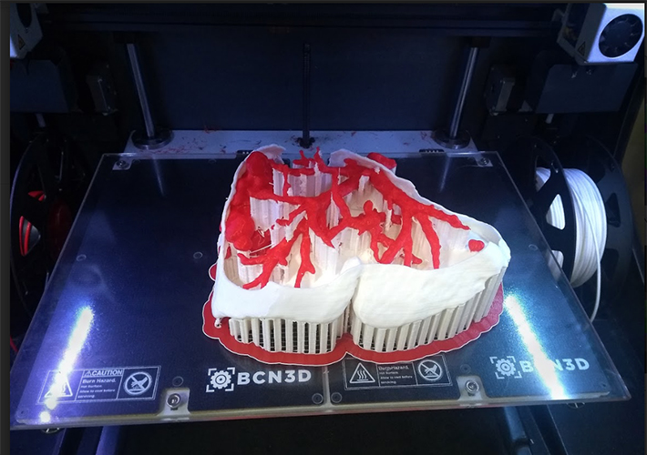 Foto La tecnología de impresión 3D de BCN3D crea modelos biomédicos que mejoran las operaciones quirúrgicas contra el cáncer.